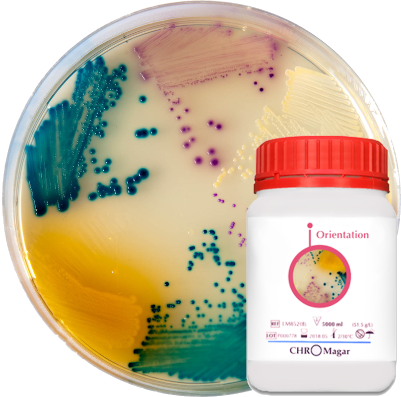 Хромогенне середовище для виділення і диференціації патогенів сечових шляхів